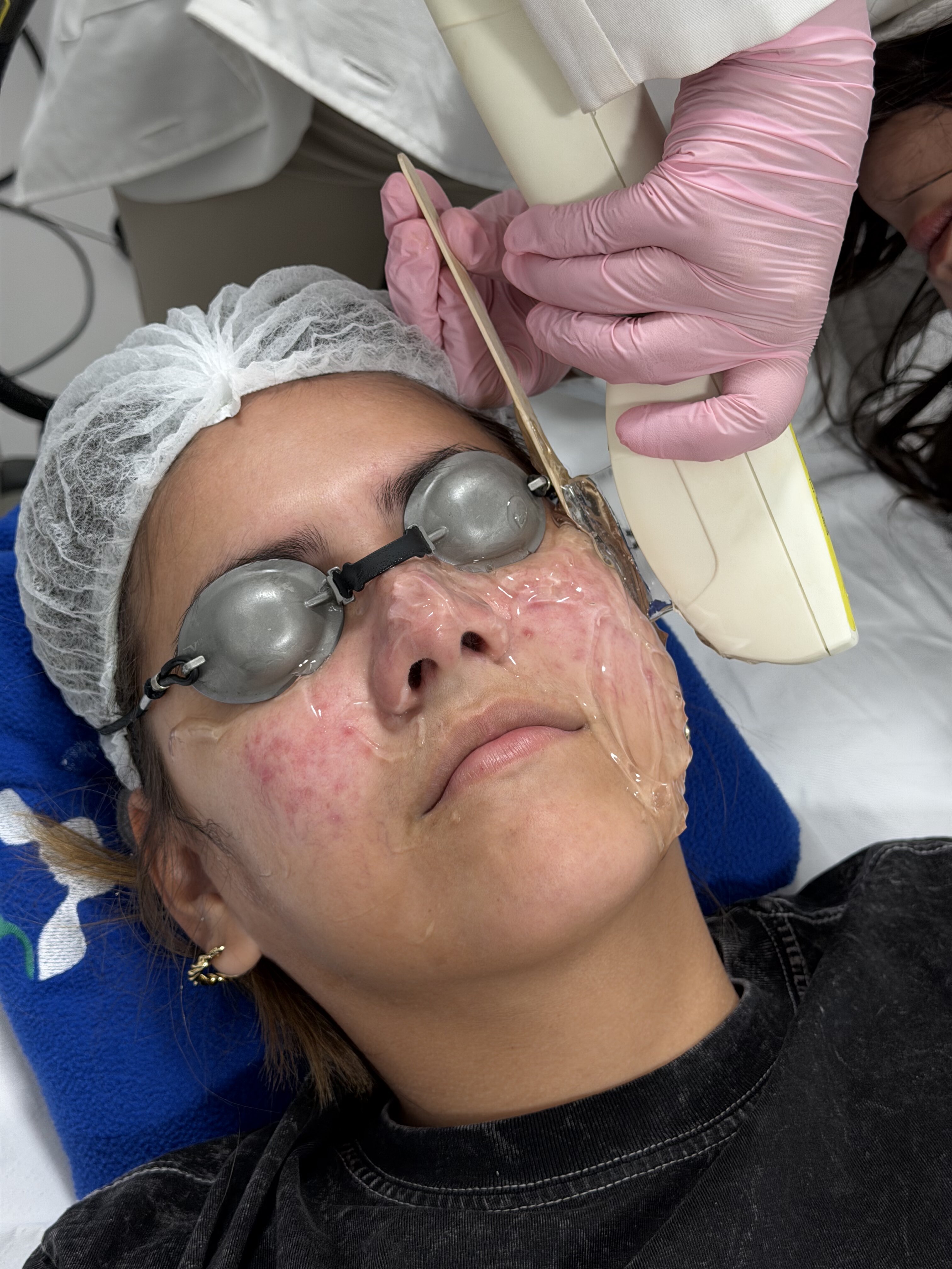 Dermatología Especializada Cliniderma