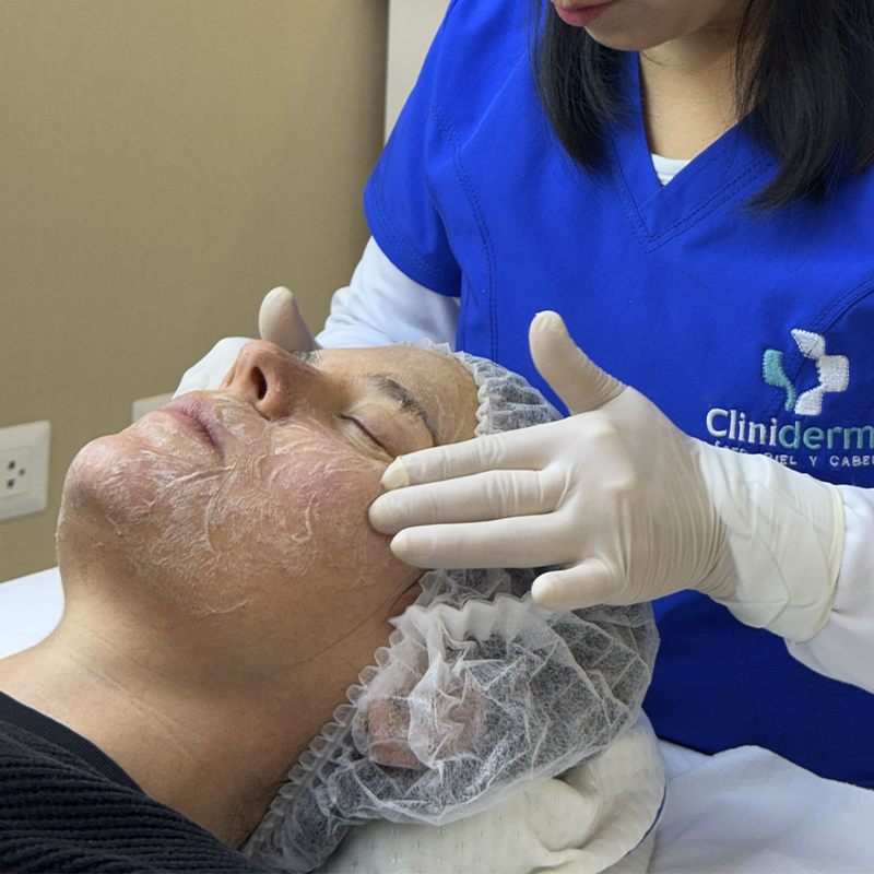 Facial Vegano